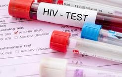 Завтра – Всероссийский день тестирования на ВИЧ 