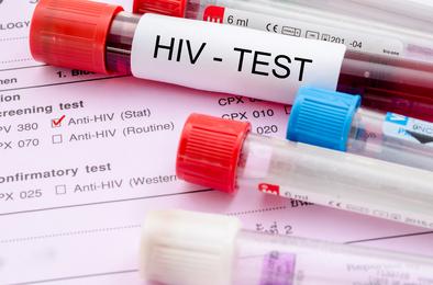 Завтра – Всероссийский день тестирования на ВИЧ 